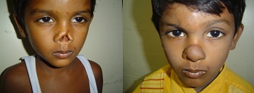 Dr.Suresh Cosmetic Surgery